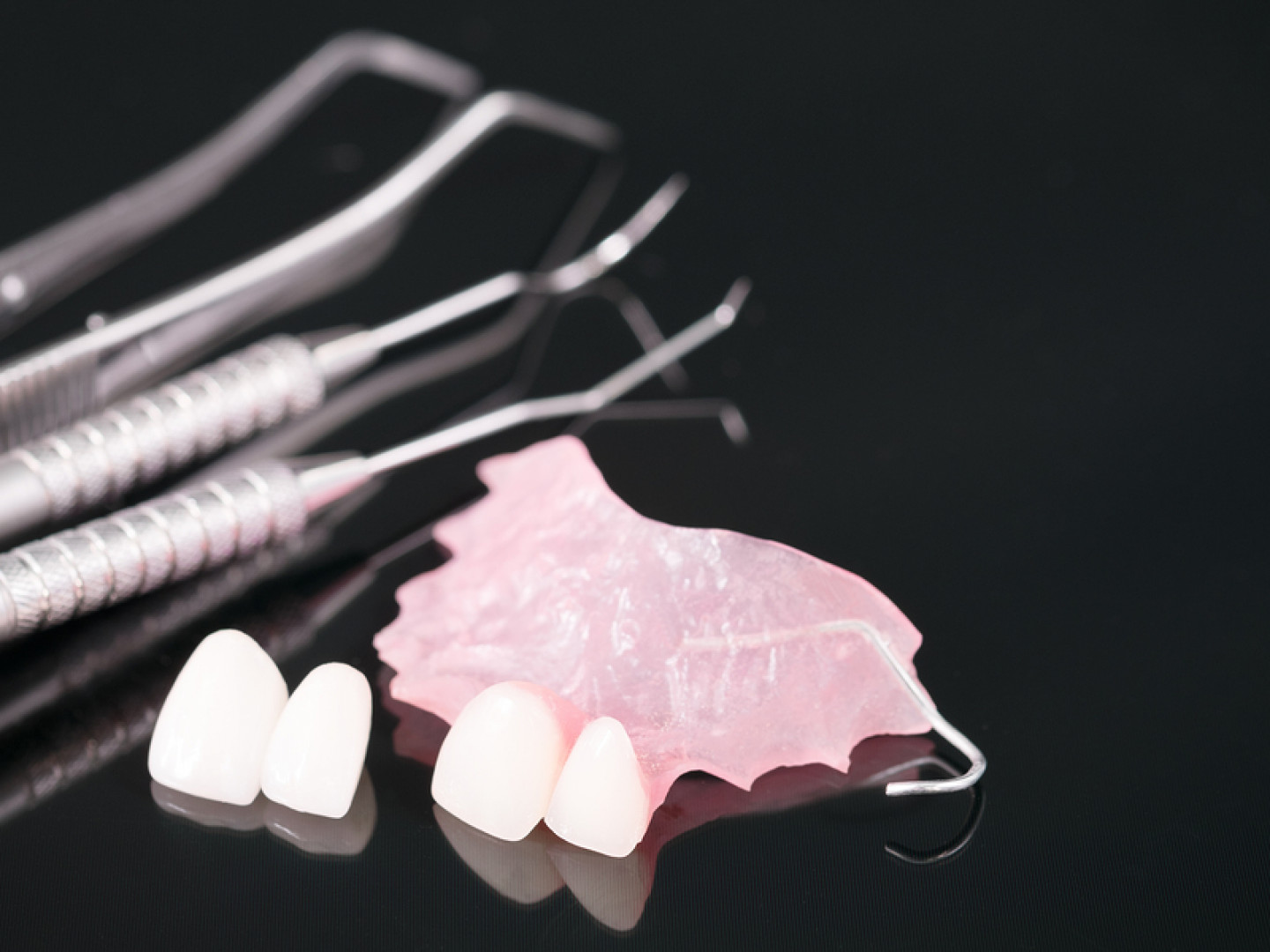Partial Dentures, Types of Partial Dentures Missoula, MT North West